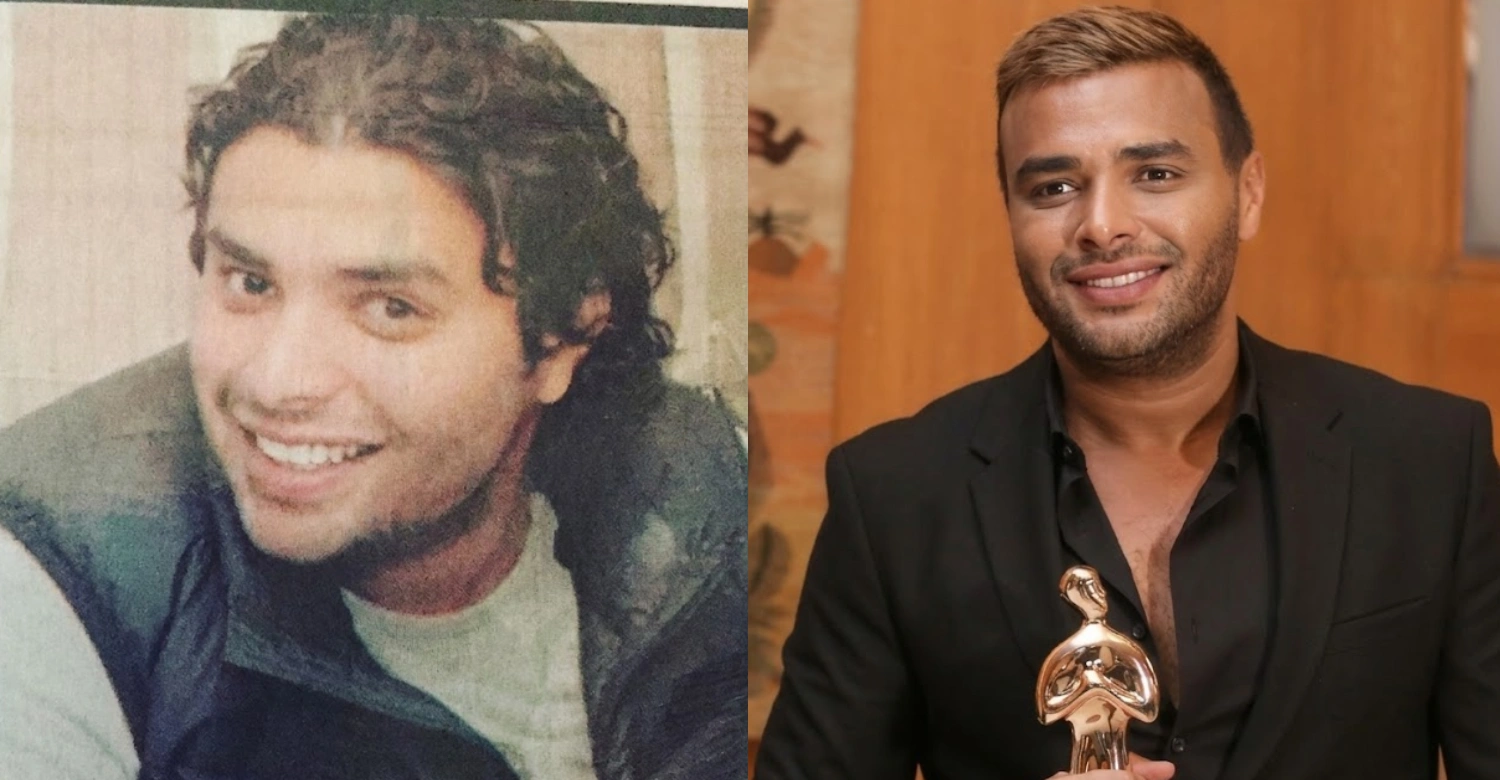 Ramy sabri before and after